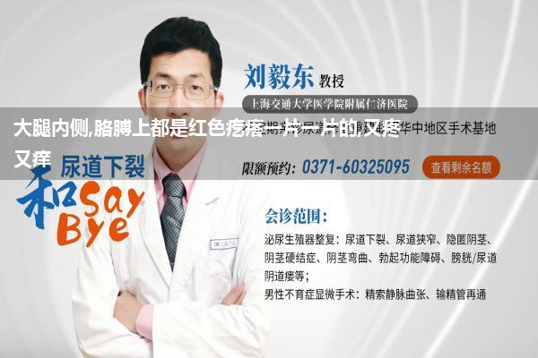 大腿内侧和腰上出红色痒疙瘩(大腿内侧起红疙瘩痒痒的怎么回事)